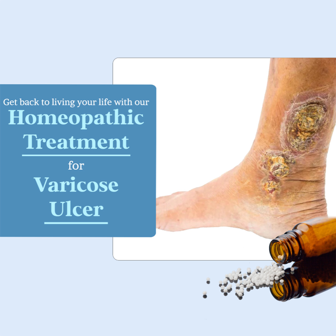 Homeopathy