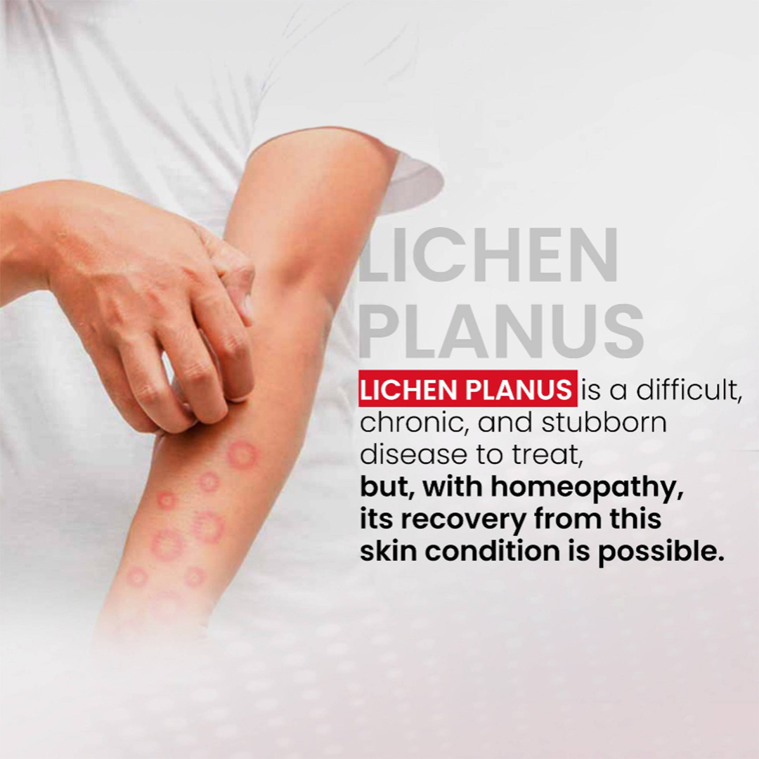 Homeopathy