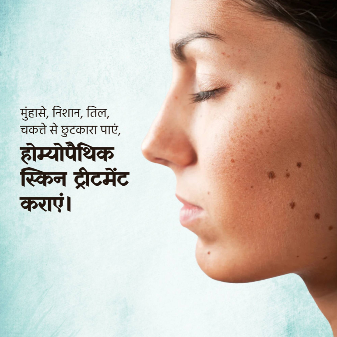 Homeopathy
