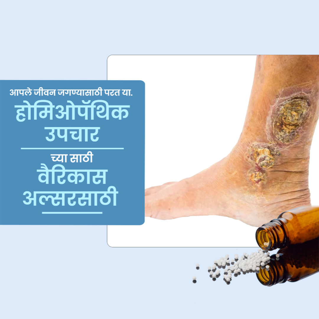 Homeopathy