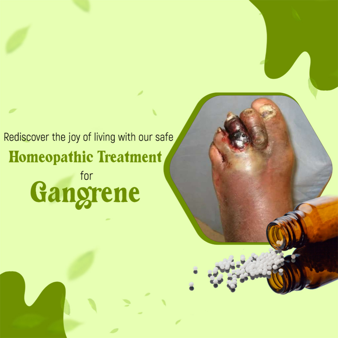 Homeopathy